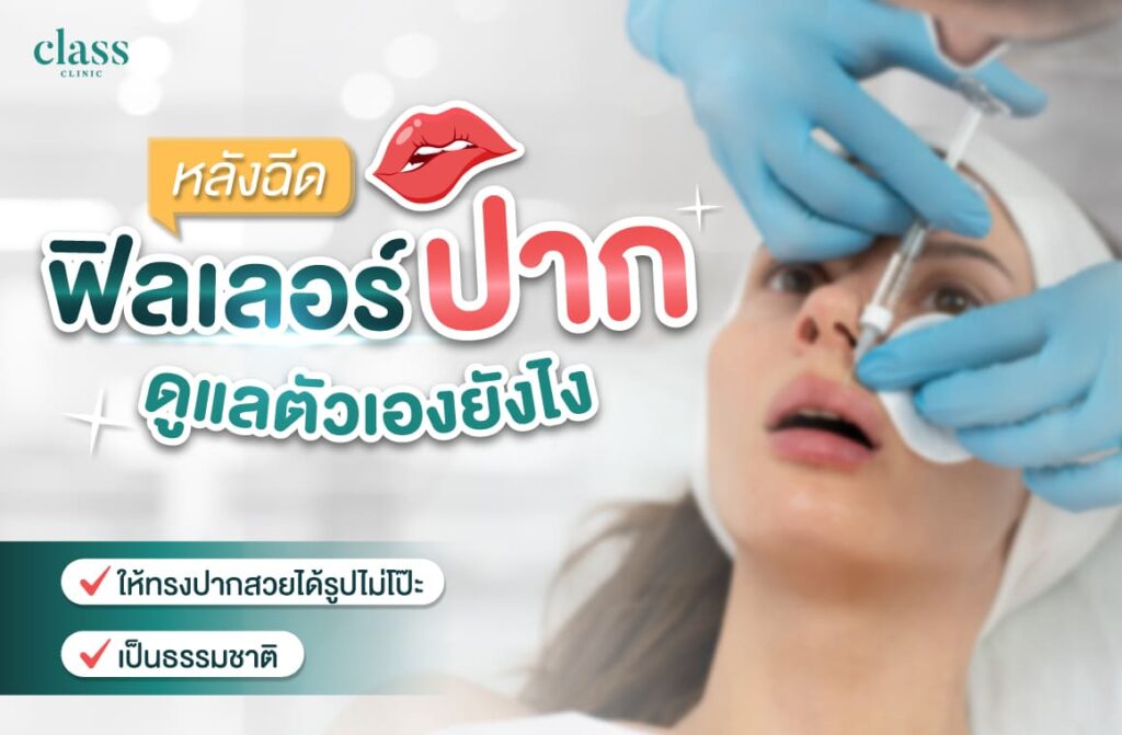 หลังฉีดฟิลเลอร์ปาก ดูแลตัวเองยังไง