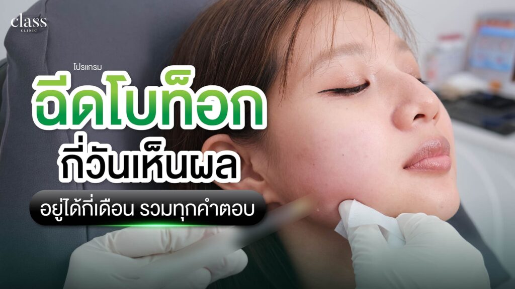 ฉีดโบท็อกกี่วันเห็นผล อยู่ได้กี่เดือน รวมทุกคำตอบ