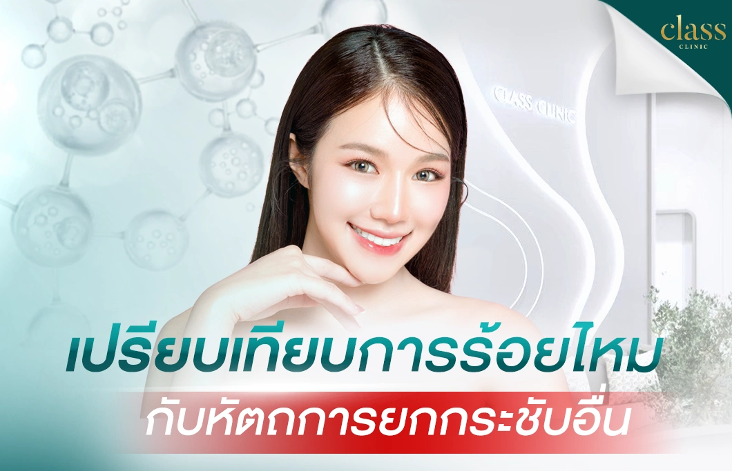 เปรียบเทียบการร้อยไหม