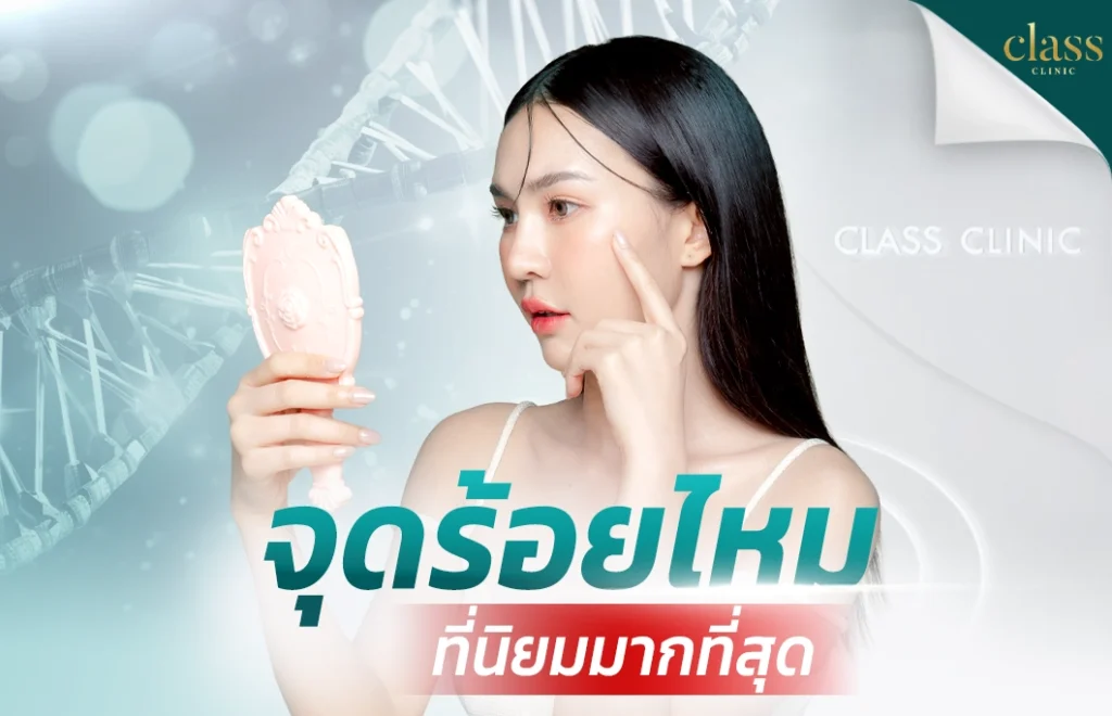 จุดร้อยไหมที่นิยม