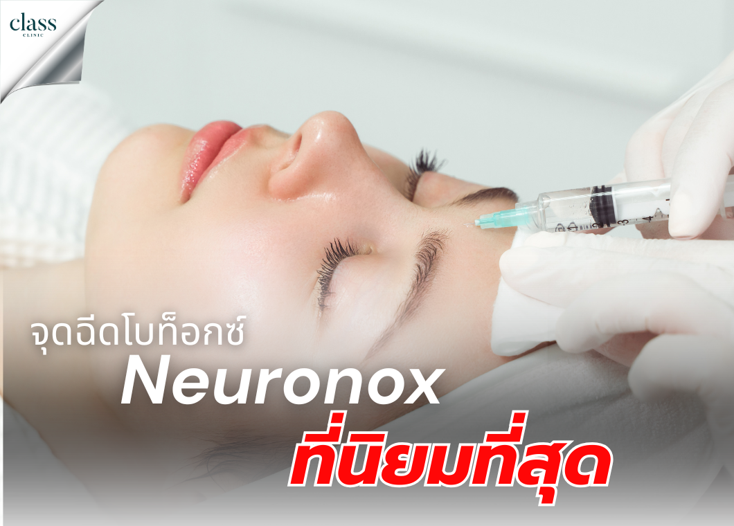 จุดฉีดโบท็อกซ์-Neuronox-ที่นิยมที่สุด