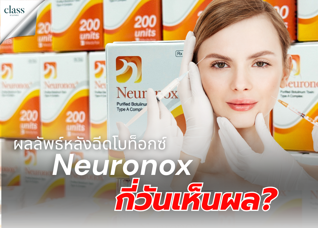 ผลลัพธ์หลังฉีดโบท็อกซ์ Neuronox กี่วันเห็นผล
