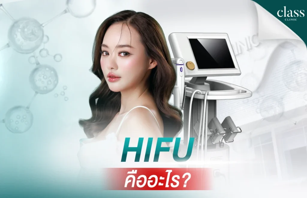 HIFU คืออะไร?