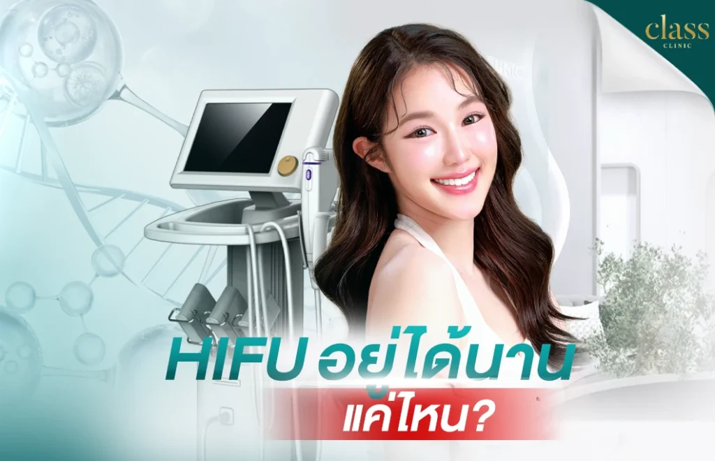HIFU อยู่ได้นานแค่ไหน?