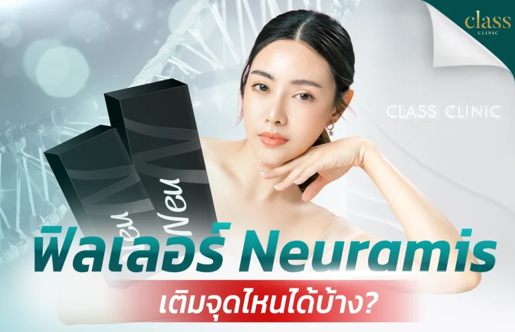 ฟิลเลอร์ Neuramis เติมจุดไหนได้บ้าง?