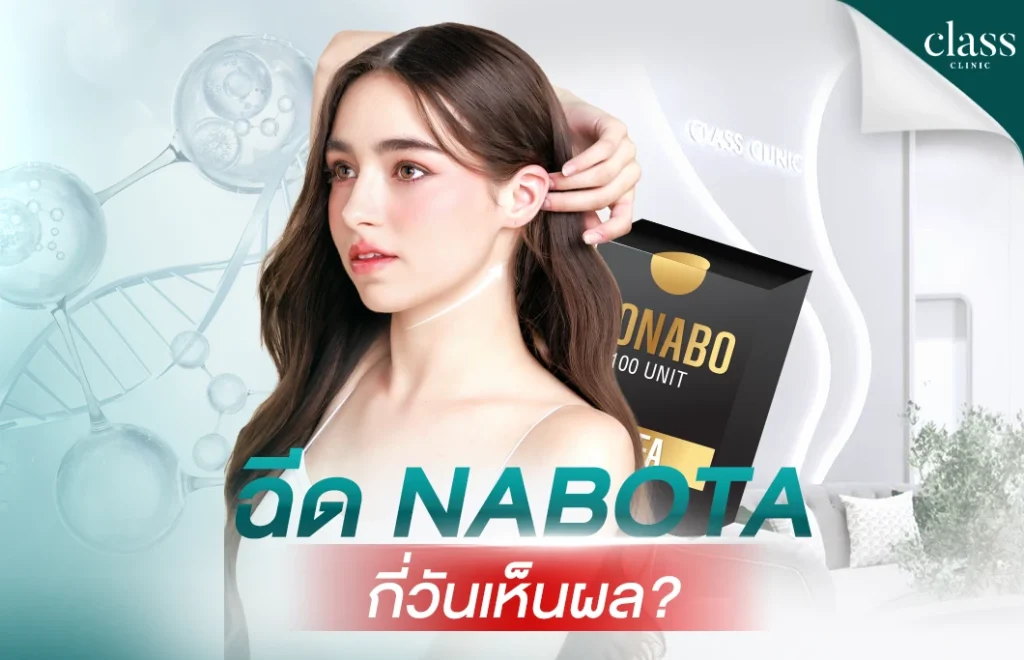 ฉีด Nabota กี่วันเห็นผล?