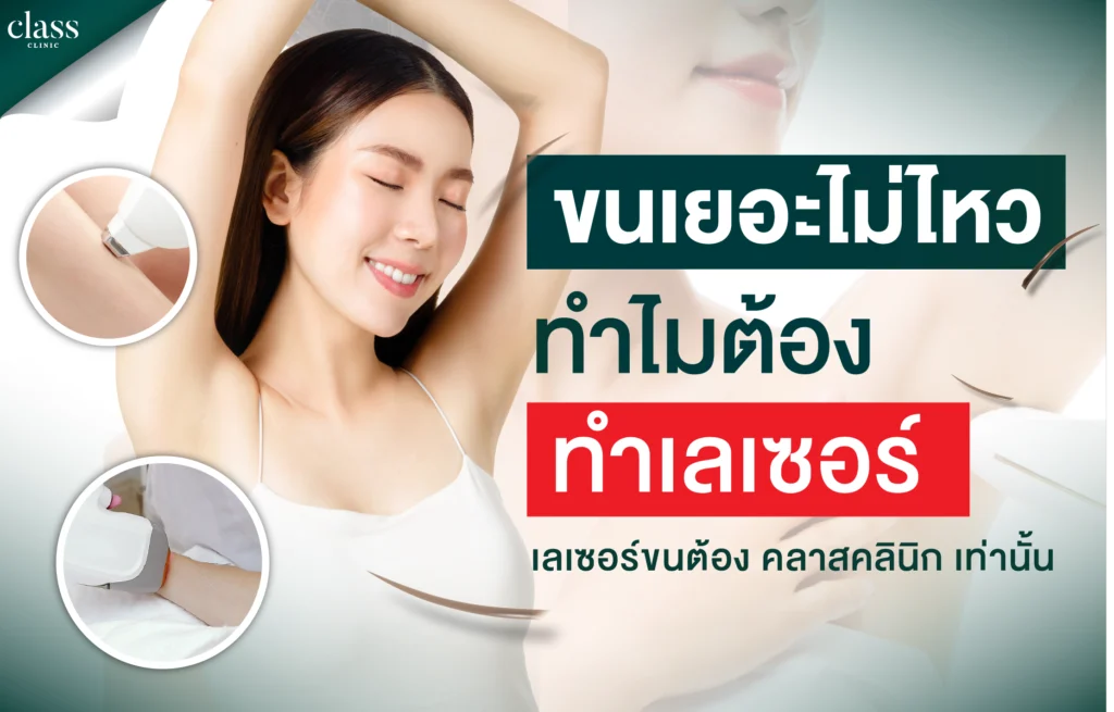 ขนเยอะไม่ไหว! ทำไมต้องเลเซอร์?