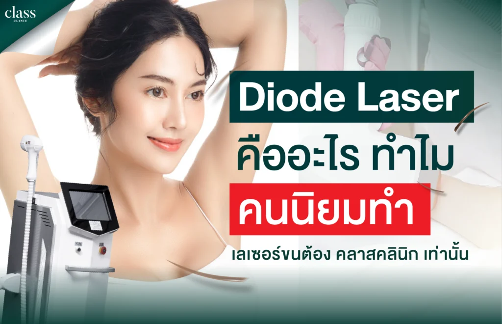 Diode Laser คืออะไร? ทำไมคนนิยมทำ