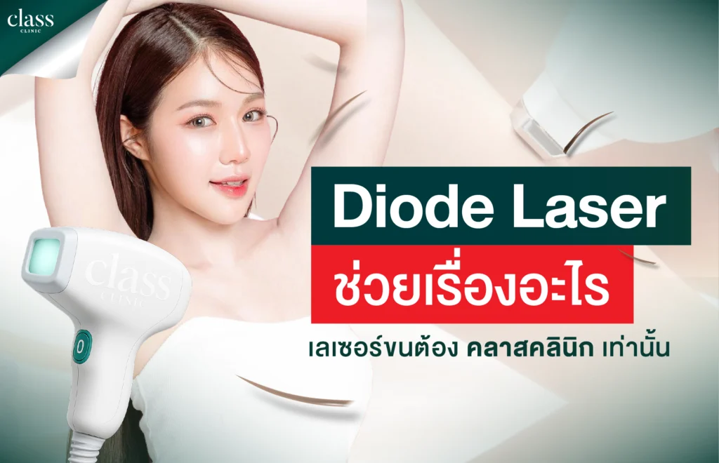 Diode Laser ช่วยเรื่องอะไร?