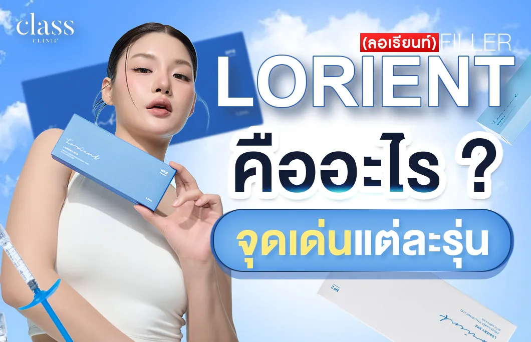 LORIENT คืออะไร?