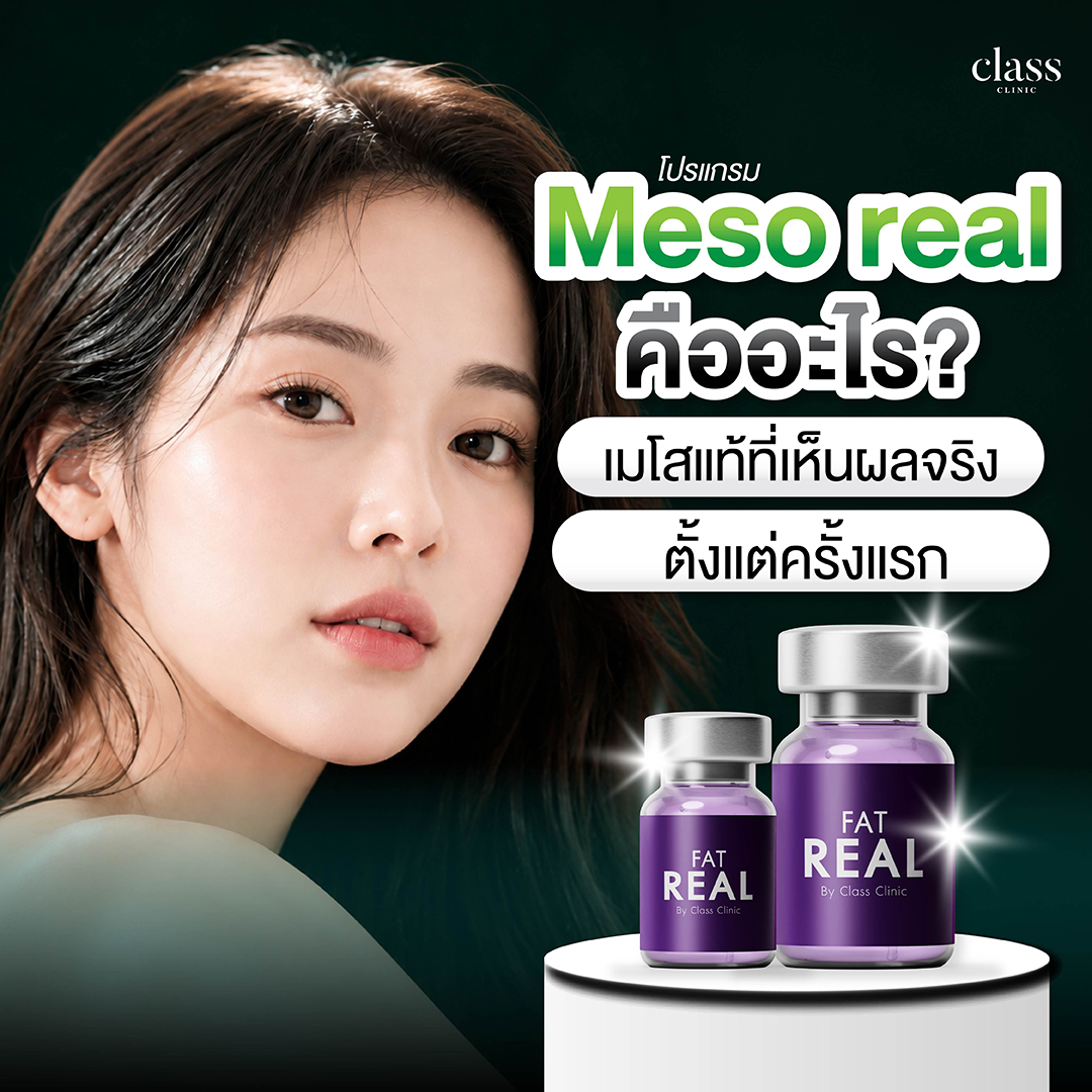 Meso real คืออะไร? เมโสแท้ที่ให้ผลลัพธ์ชัดกว่าเมโสทั่วไป