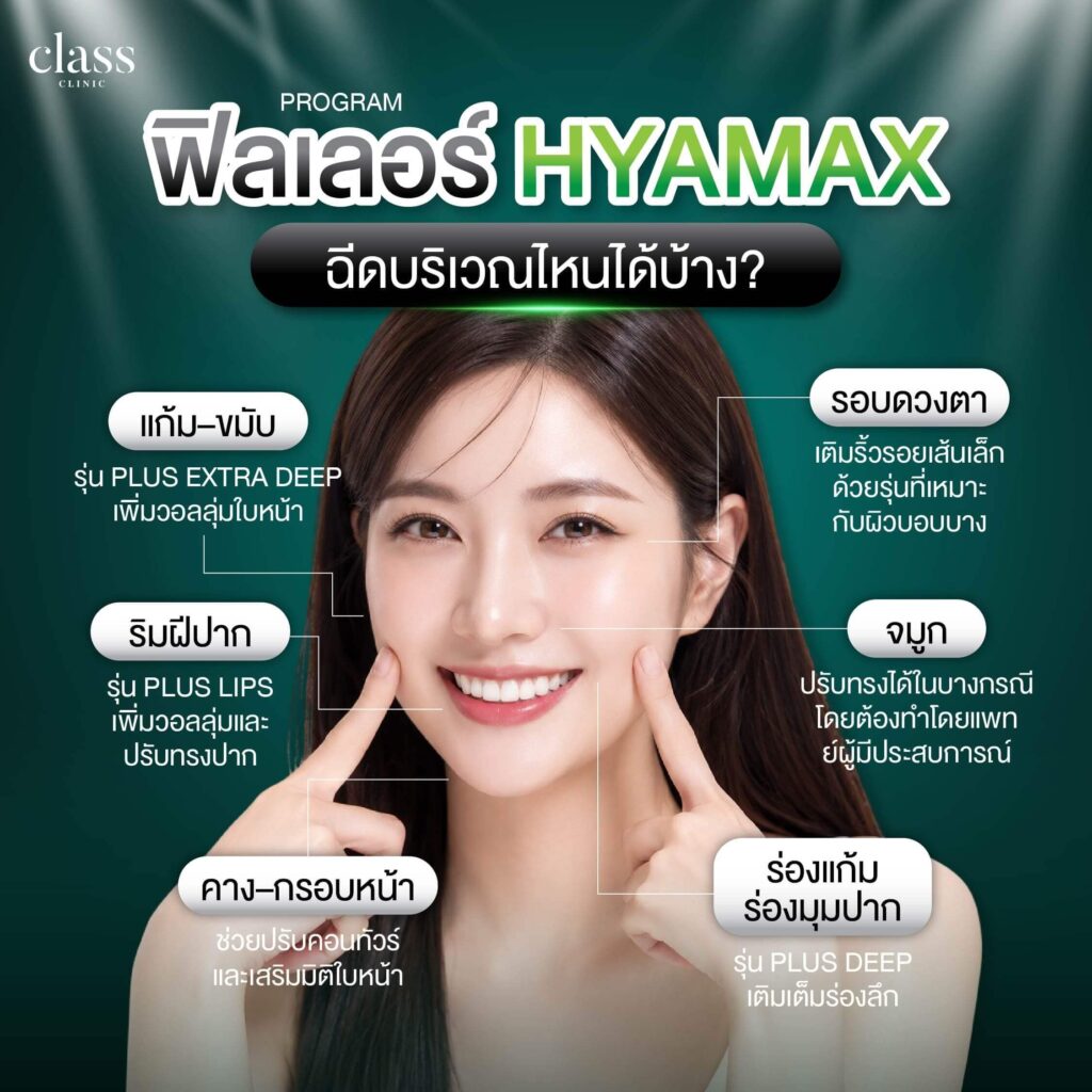 ฟิลเลอร์ Hyamax ฉีดบริเวณไหนได้บ้าง?