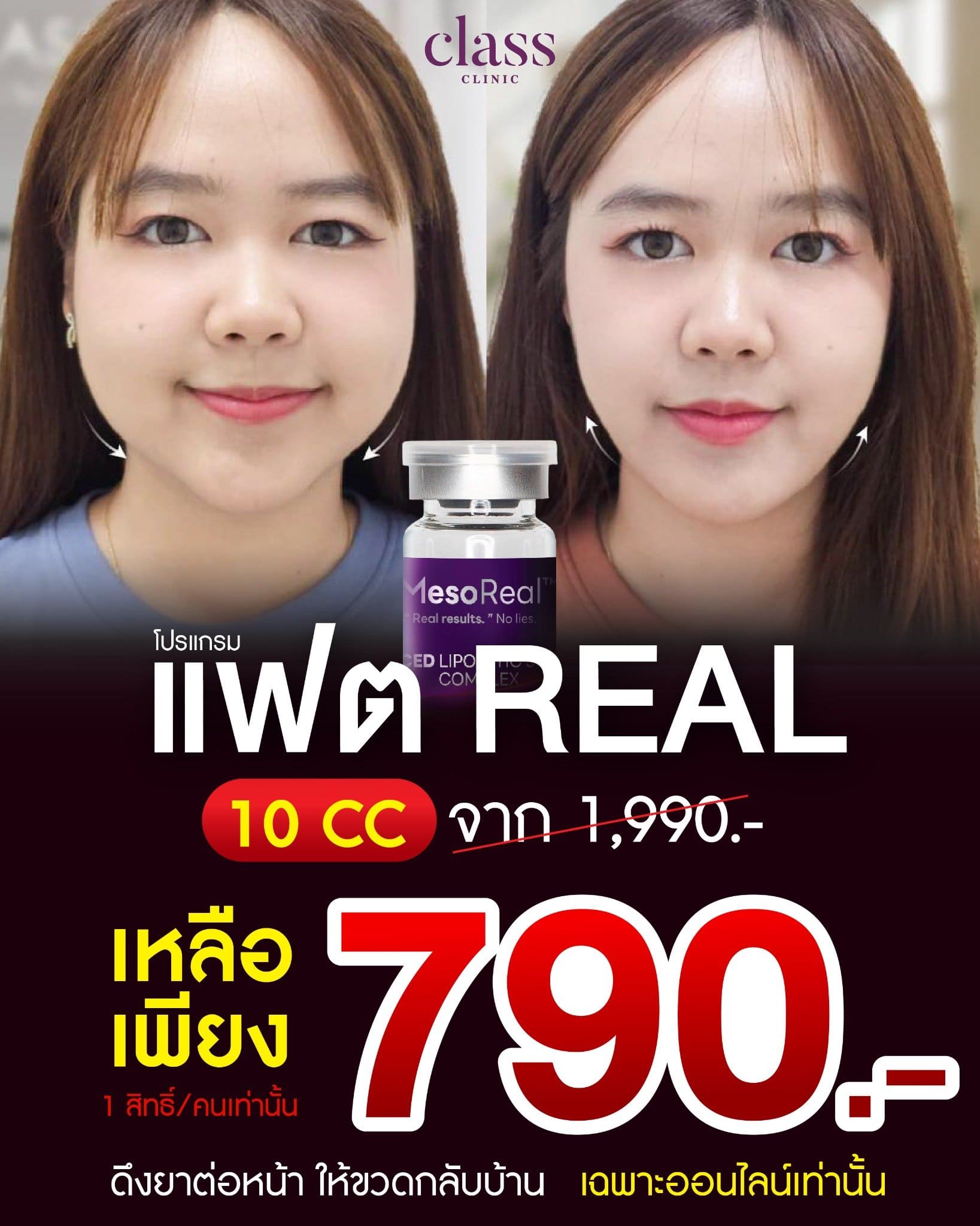 โปรโมชัน