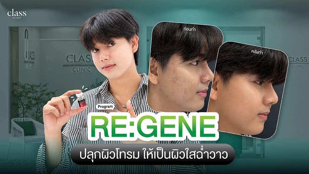 REGENE คืออะไร กู้ผิวโทรมให้ผิวโกลว์ได้จริงไหม
