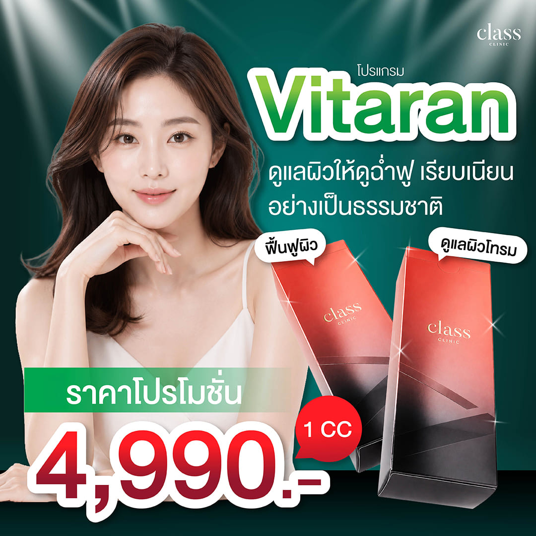 Vitaran ราคาเท่าไหร่ ?