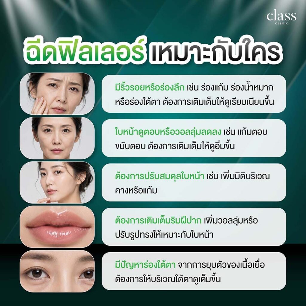 ฉีดฟิลเลอร์ เหมาะกับใคร