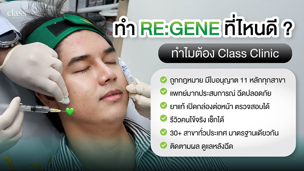 ทำ REGENE ที่ไหนดี ทำไมต้อง Class Clinic