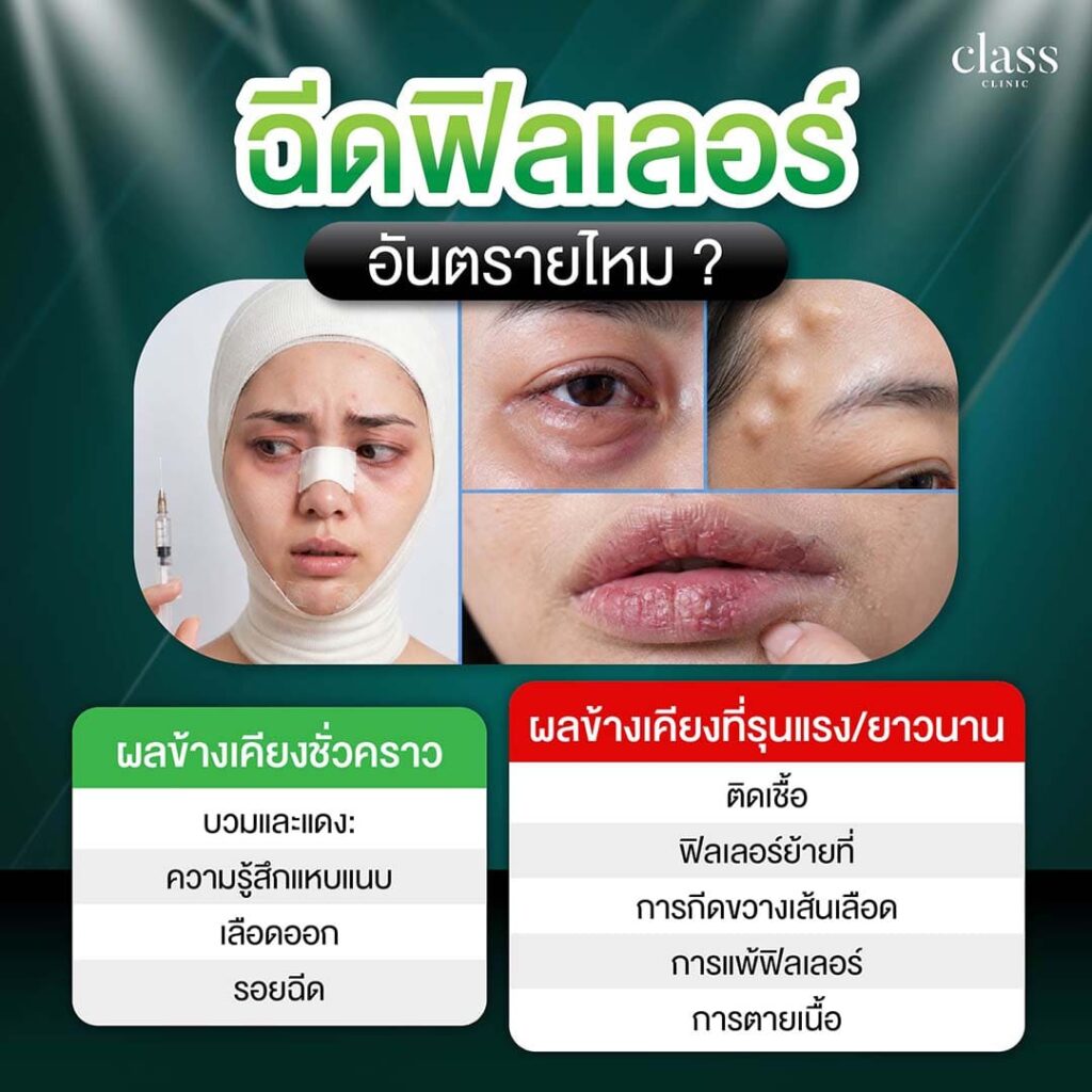 ฟิลเลอร์แท้อันตรายไหม?