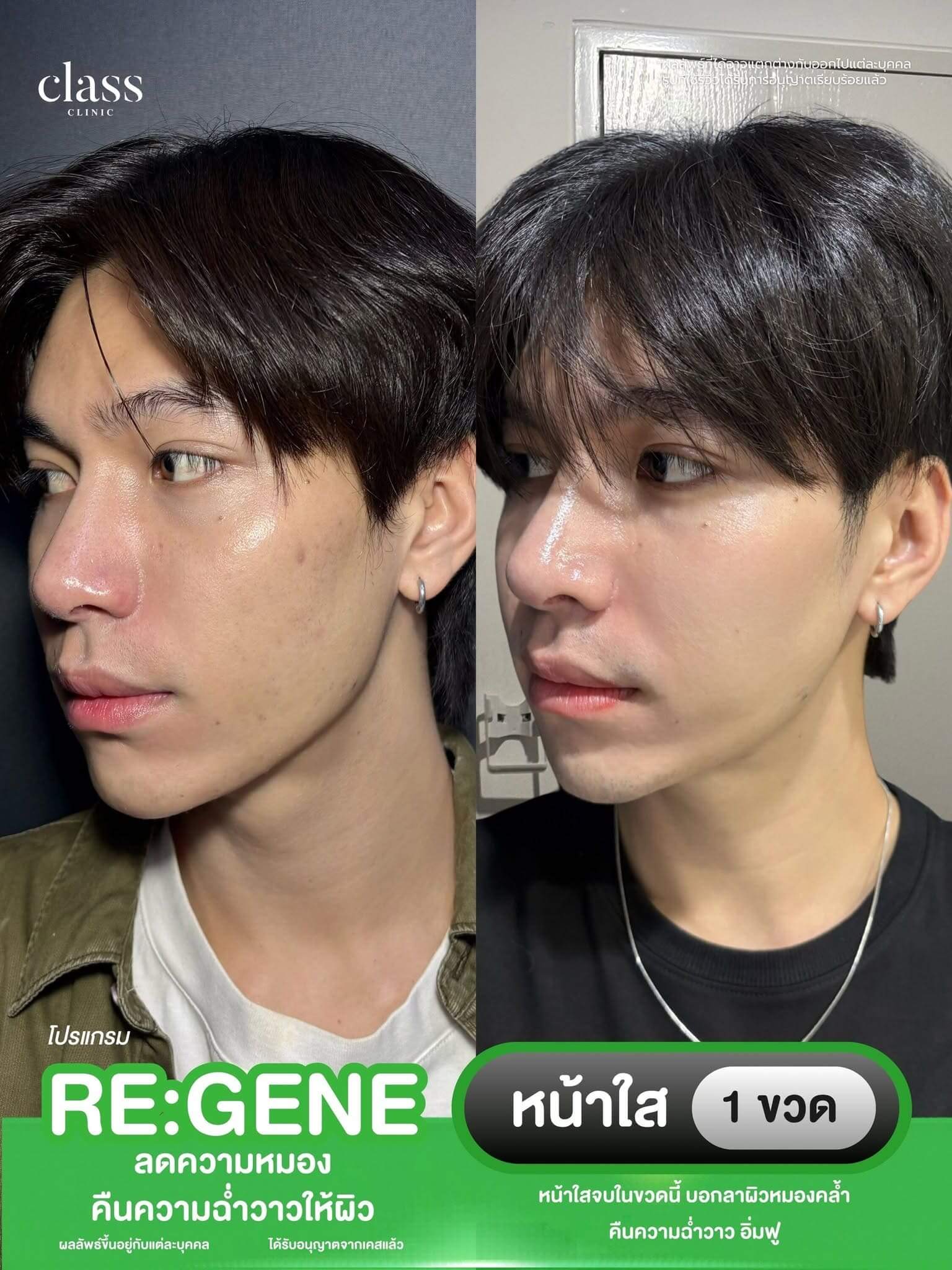 รีวิวโปรแกรม REGENE