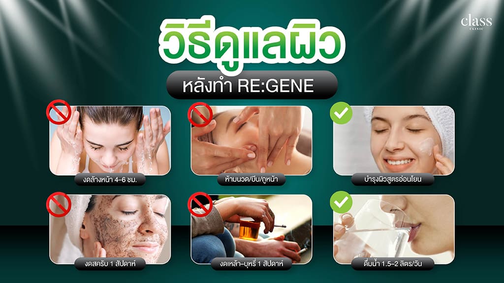 วิธีดูแลผิวหลังทำ REGENE