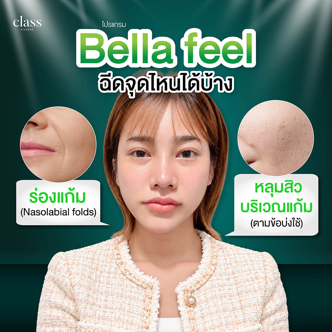 Bella feel ฉีดจุดไหนได้บ้าง