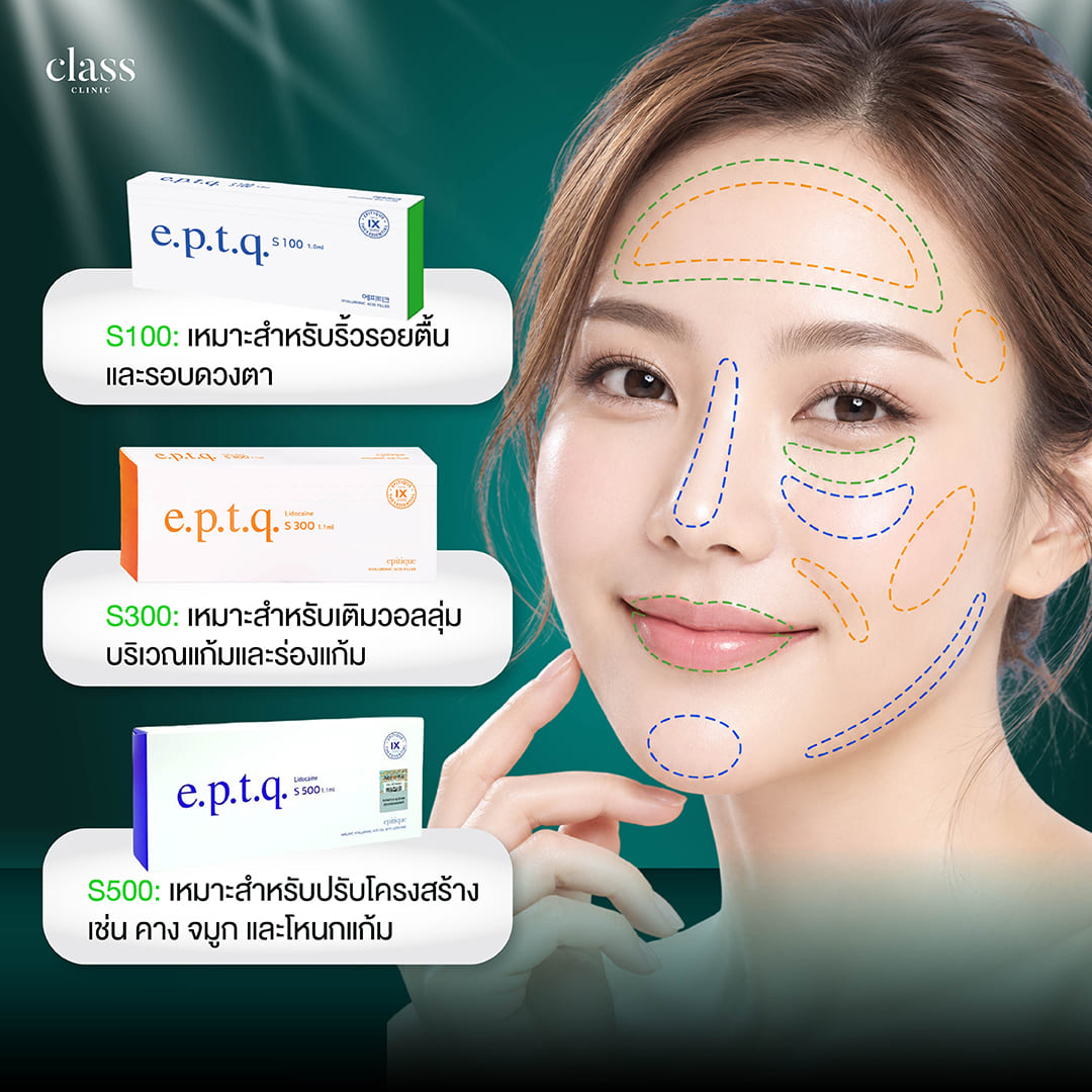 ฟิลเลอร์ e.p.t.q. มีกี่รุ่น อะไรบ้าง ?