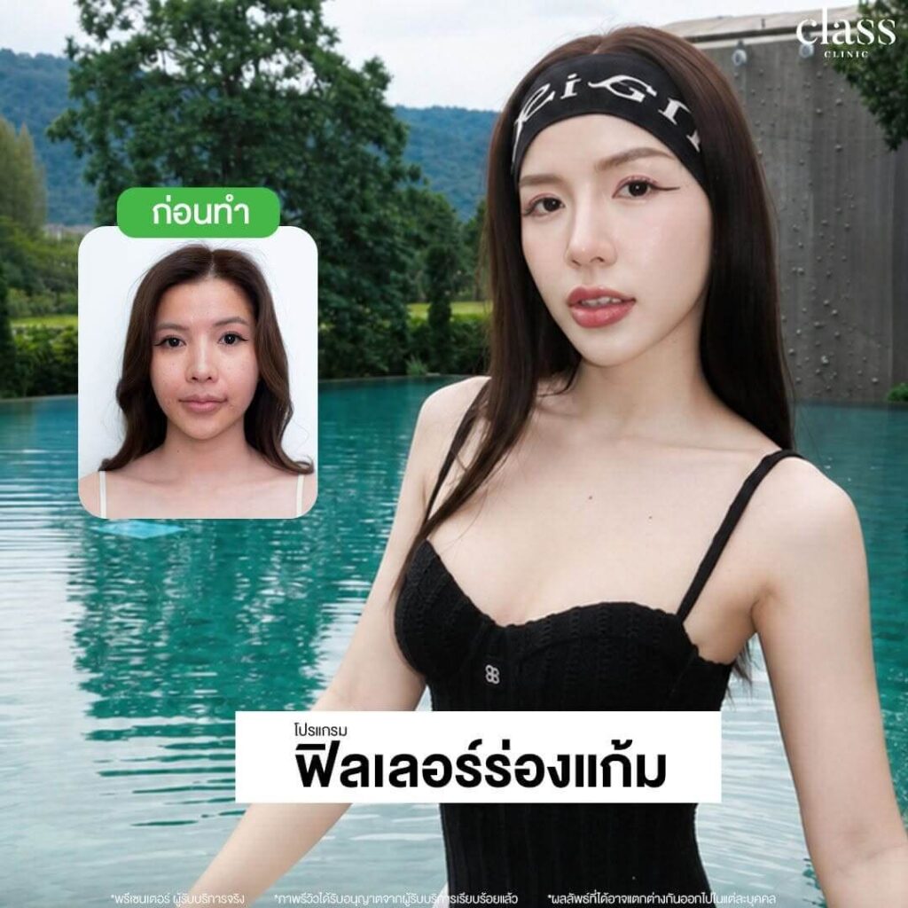 รีวิว Class Clinic