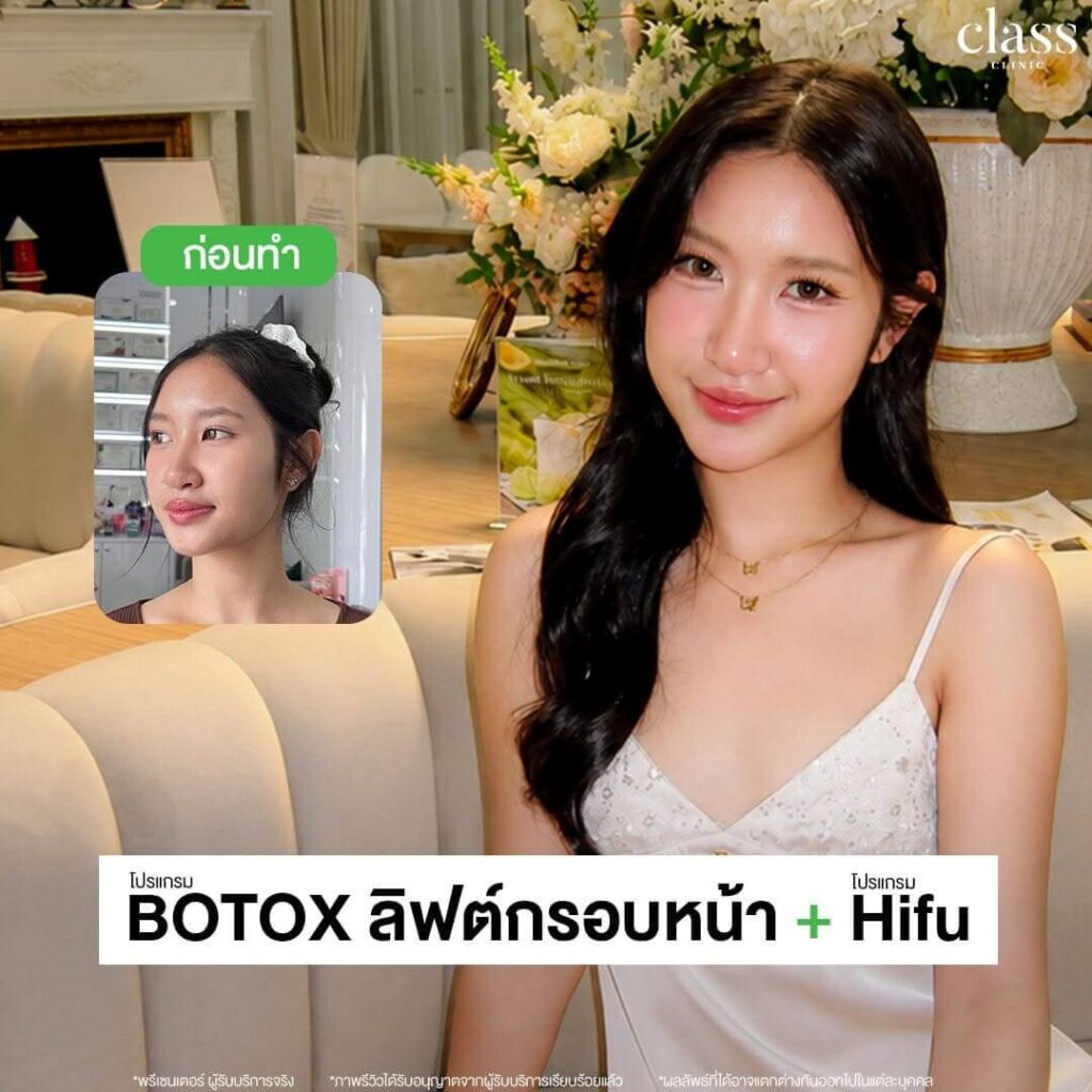 รีวิว Class Clinic