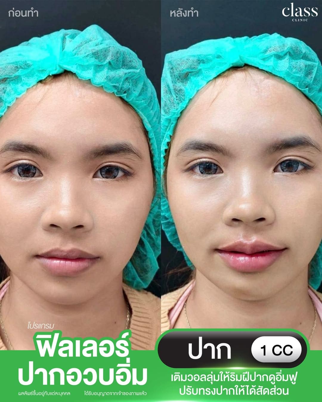 รีวิวลูกค้าClassClinic