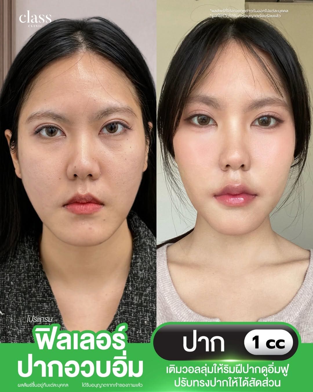 รีวิวลูกค้าClassClinic
