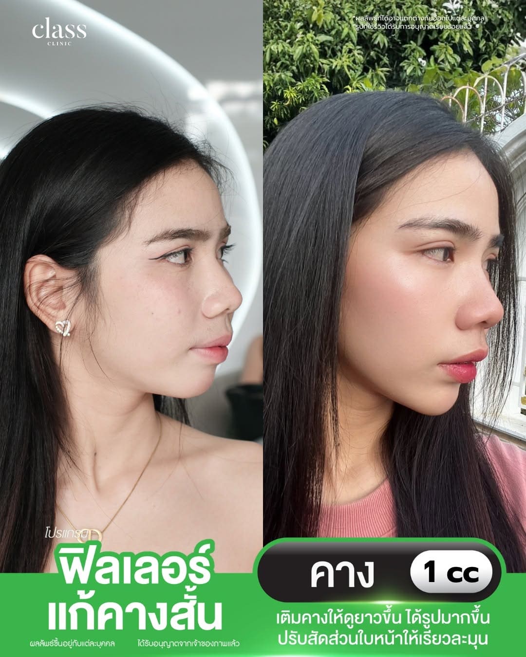 รีวิวลูกค้าClassClinic