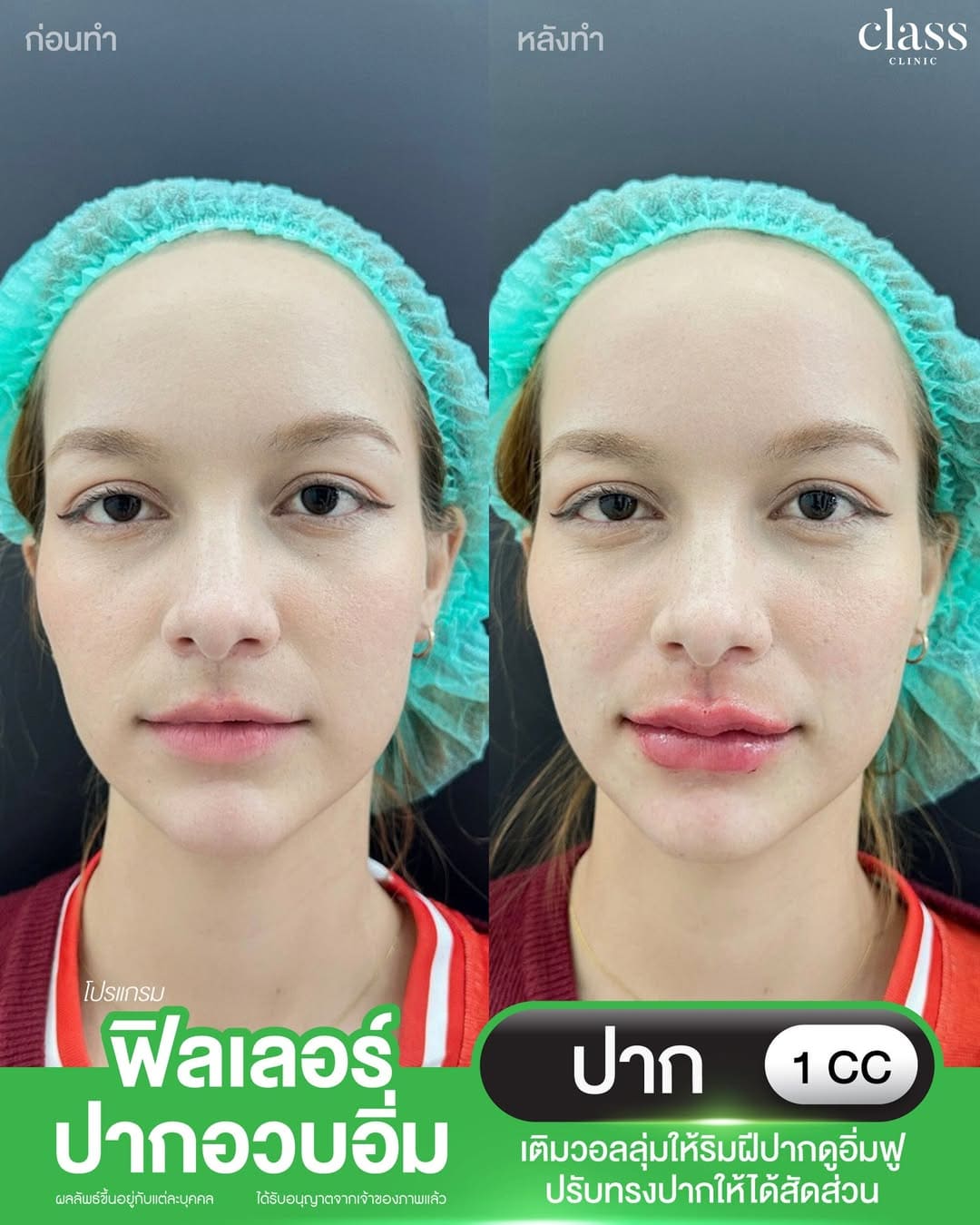 รีวิวลูกค้าClassClinic