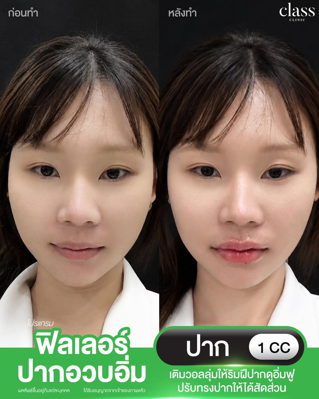 รีวิวลูกค้าClassClinic