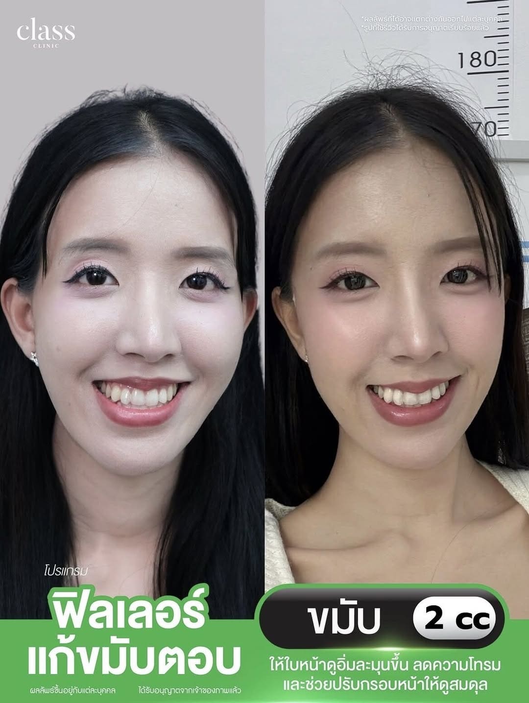 รีวิวลูกค้าClassClinic