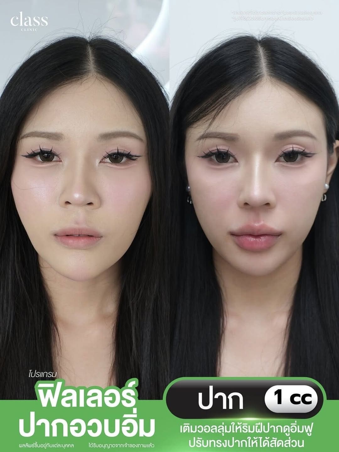 รีวิวลูกค้าClassClinic