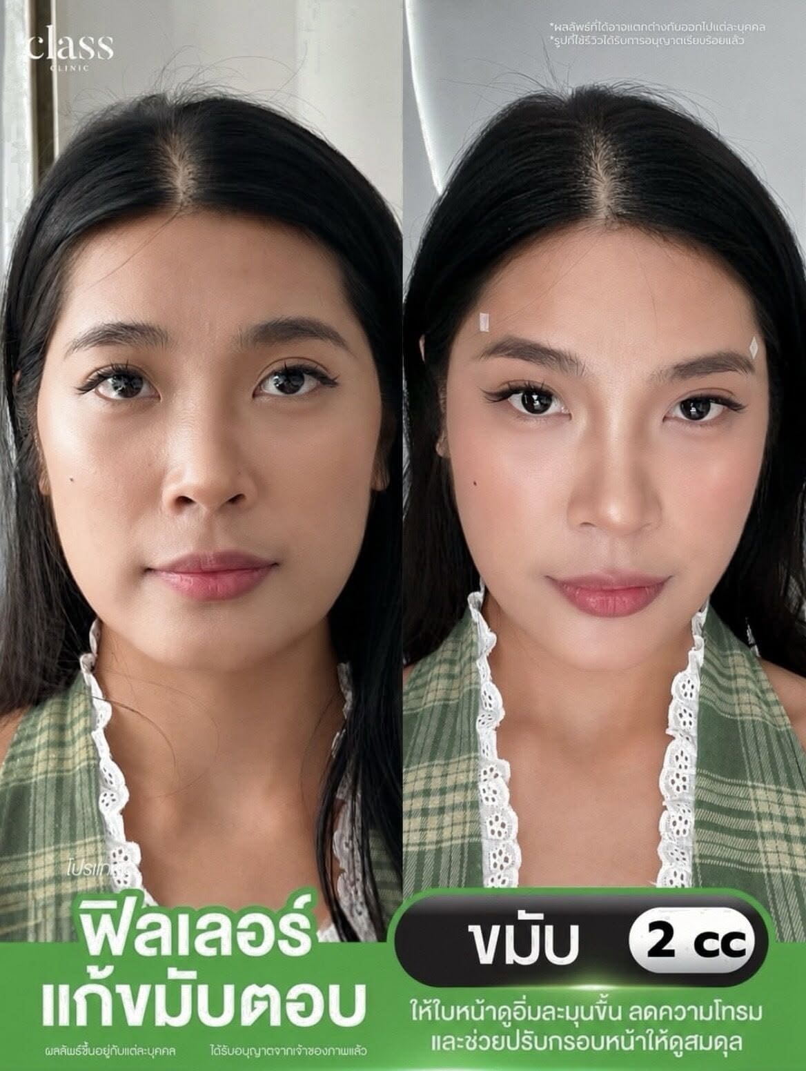 รีวิวลูกค้าClassClinic
