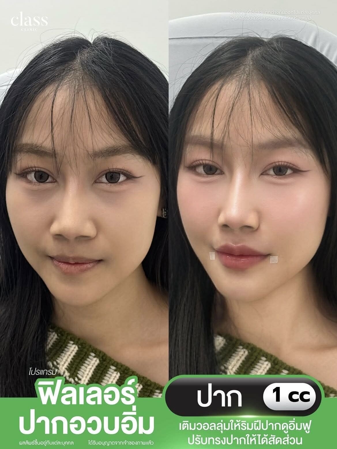 รีวิวลูกค้าClassClinic