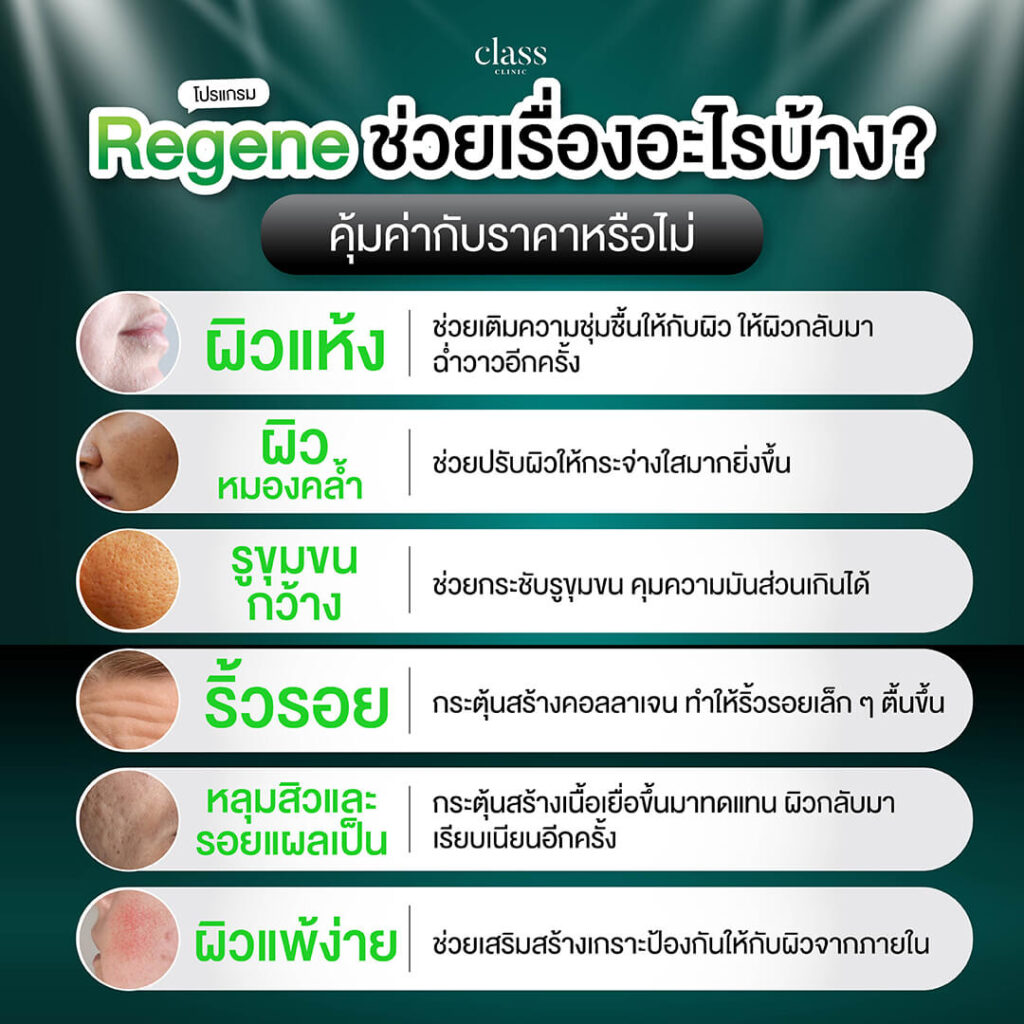 Regene ช่วยเรื่องอะไรบ้าง? คุ้มค่ากับราคาหรือไม่