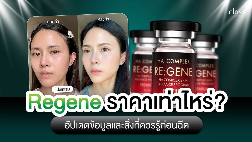 Regene ราคาเท่าไหร่? อัปเดต 2026 และสิ่งที่ควรรู้ก่อนฉีด
