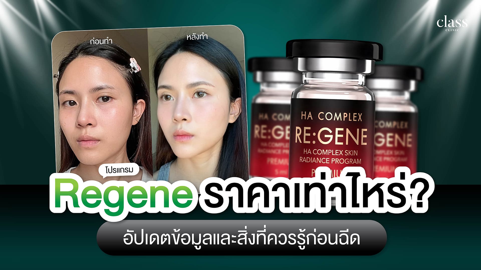 Regene ราคาเท่าไหร่? อัปเดต 2026 และสิ่งที่ควรรู้ก่อนฉีด